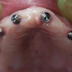 Dr. Alfonso Gonzalez Ocaranza, Dentista - Odontólogo