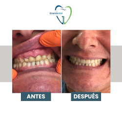 Dr. Arturo Romero Grande, Dentista - Odontólogo