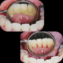 Dr. Brondo Odontología Integral Especializada