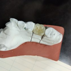 Dr. Daniel Sandoval Guevara. Dentista Especialista En Protesis Bucal E Implantologia