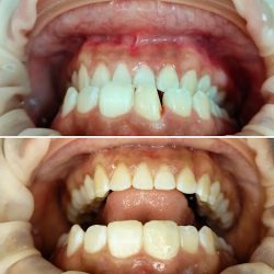 Dr. Edgar Garcia (dentista, Odontologo)