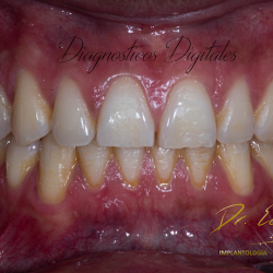 Dr Edgar Zamora Especialista En Rehabilitación Oral E Implantologia, Ortodoncia