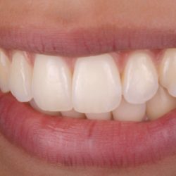 Dr. Erasmo Yuriar, Dentista - Odontólogo