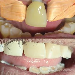 Dr. Ernesto Antonio Montaño Pérez, Dentista - Odontólogo