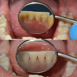 Dr. Fernando Paredes - Dentista General