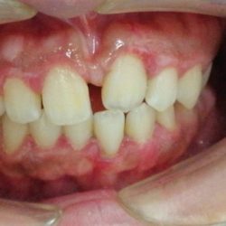 Dr. Jesús Carrillo Montemayor, Dentista - Odontólogo