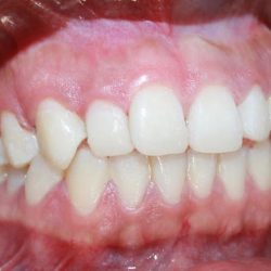 Dr. Jonathan Ortiz Zorraquin, Dentista - Odontólogo