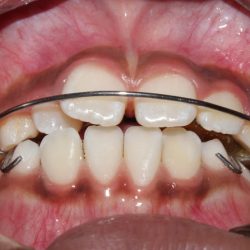 Dr. Jonhny A. Valdez *odontologia Integral*