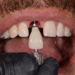 Dr. Jorge Rafael Calderón Velázquez, Dentista - Odontólogo
