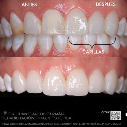 Dr. Juan Carlos Guzmán Castañeda - Rehabilitación Oral Y Estética