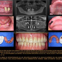 Dr. Leonel Brito Armas, Dentista - Odontólogo
