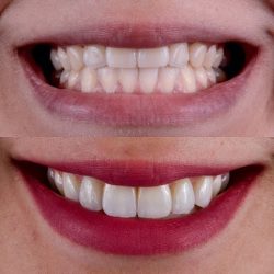 Dr. Mauricio Villegas Akena, Dentista - Odontólogo