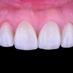 Dr. Mijail Preciado | Dentista En Guadalajara Odontología General & Cosmética Dental