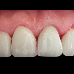 Dr. Nahim Ivan Valenzo Guillen, Dentista - Odontólogo