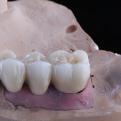 Dr. Néstor Colín Osornio, Dentista - Odontólogo