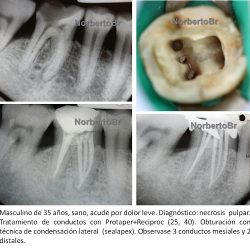 Dr. Norberto Broon