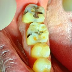 Dr. Odilón Camarena (rehabilitación Y Estética Dental. Disfución Temporomandibular)
