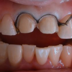 Dr. Rigoberto Cabrera Sánchez, Dentista - Odontólogo