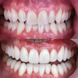 Dr. Santiago Ortiz Ruiz, Dentista - Odontólogo