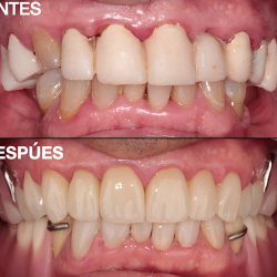 Dra. Aide Montserrat Orozco Gutierrez, Dentista - Odontólogo