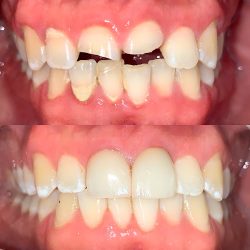 Dra. Cynthia Medrano - Oa Odontología Avanzada
