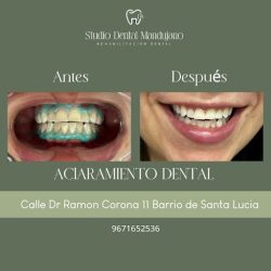 Dra. Esperanza Mandujano Moreno, Dentista - Odontólogo