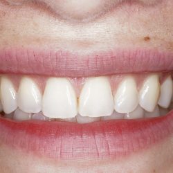 Negocio Dra. Hatsuko Yalí, Dentista - Odontólogo