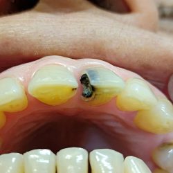 Dra. Iris NuÑez De Avila / Dentista / Construyendo Sonrisas/ Dentco