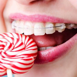 Dra. Iris Ocampo, Dentista, Brackets, Ortodoncista, Ortodoncia, Braces.