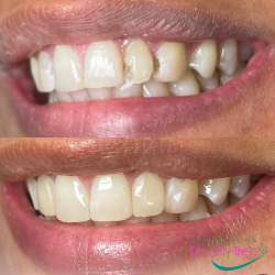 Dra. Lety Trejo. Diseñadora De Sonrisas