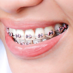 Dra Liliana Martín - Orto Smile - Ortodoncia Y Odontología General