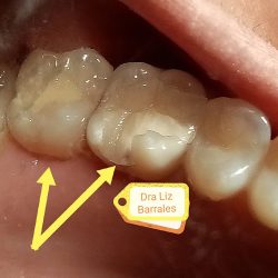Dra. Liz Barrales...dentista