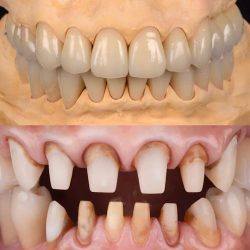 Dra. Lorena Cervantes Hurtado. Odontología Integral Y Estética Dental