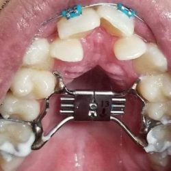 Dra. Ma Lourdes Espinosa Colunga, Dentista - Odontólogo