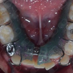 Dra. Mariana Beltrán González, Dentista Niños - Odontopediatra