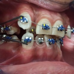 Dra. Maritza Calderon Cornejo, Dentista - Odontólogo