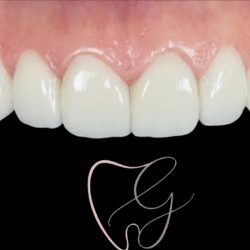 Dra. T. Giovanna Pérez Martínez, Dentista - Odontólogo