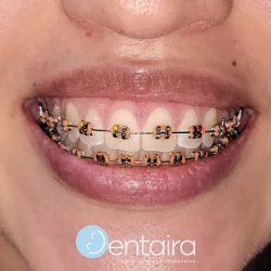 Dra. Tania Perales, Dentista - Odontólogo