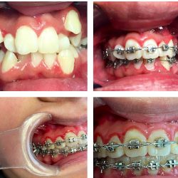 Dra Verónica Méndez Hernández, Dentista Y Ortodoncista ,san Cristobal Ecatepec.