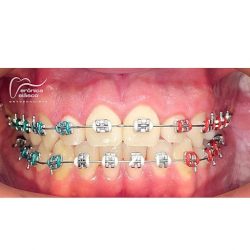 Dra. Veronica Velasco Garcia, Dentista - Odontólogo
