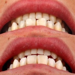 Edent Clinica Dental