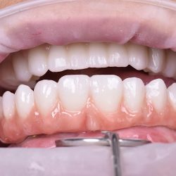 Enamelex Clinica Dental