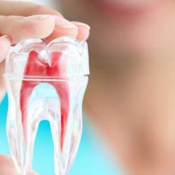 Endodoncia En Irapuato | Undoctorparati