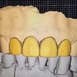 Endodoncia Y Endoperio