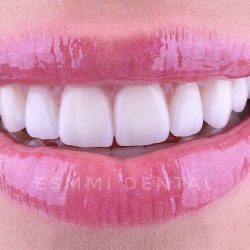 Esmmi Dental