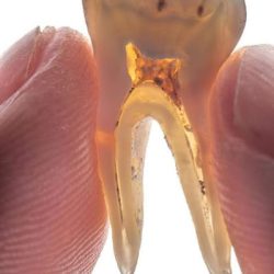 Especialidades Dentales Dra. Yuliana Vazquez (cirujano Dentista-especialista En Ortodoncia)