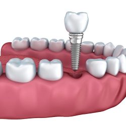 Especialidades Dentales Sendero