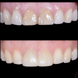 Especialista En Estética Dental E Implantes Dr. Pablo Hdez