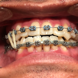 Estética Dental, Cirugía Dental Y Ortodoncia. Dra. Gabriela Avecilla Guerrero