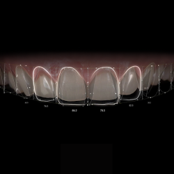 Estética Dental Dra. Karla Ramírez - Best Cosmetic Dentist In Tijuana